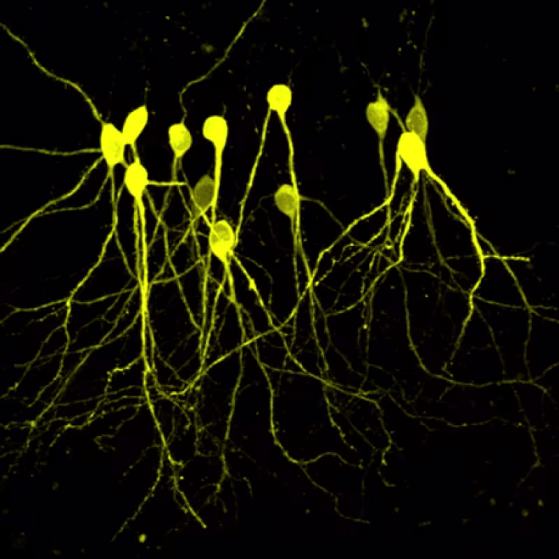 Arc in Granule Cells