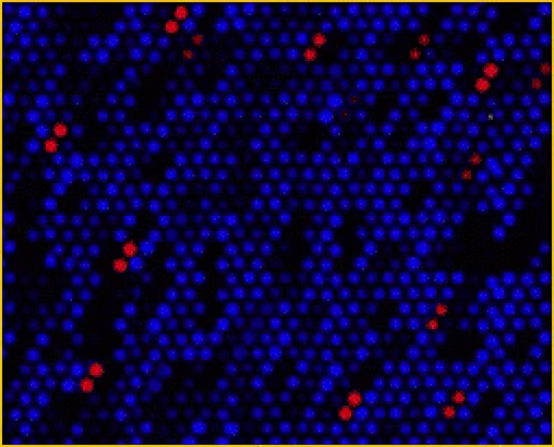 Figur som viser autoantistoffer, antistoffer som er rettet mor kroppens egne proteiner