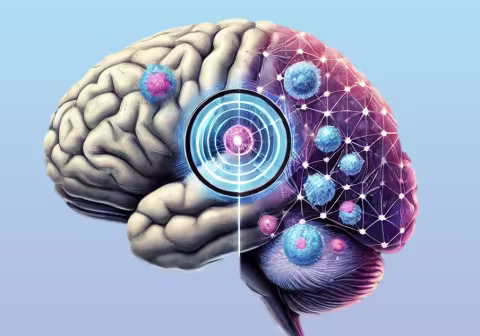 AI brain