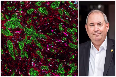 Detaljerte bilder av vevet rundt kreftcellene er sentrale i arbeidet til CCBIO og direktør Lars A. Akslen.