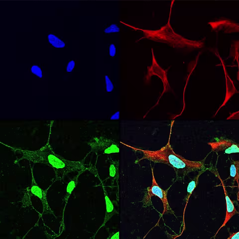 Increased traction for cancer neuroscience at CCBIO: Recruitment of top researcher from the US | UiB