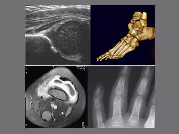 Images using ultrasound, 3D CT, MRI and x-ray, respectively.