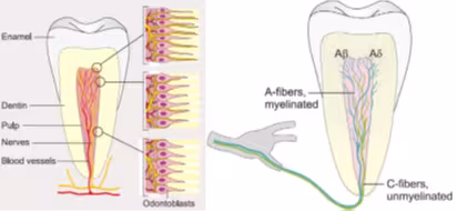 Schematic illustration of the intradental innervation