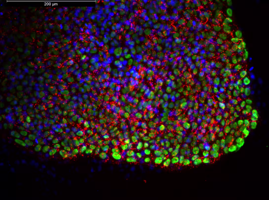 iPSC stained with SSEA4 (red), OCT4 (green) and DAPI (blue)