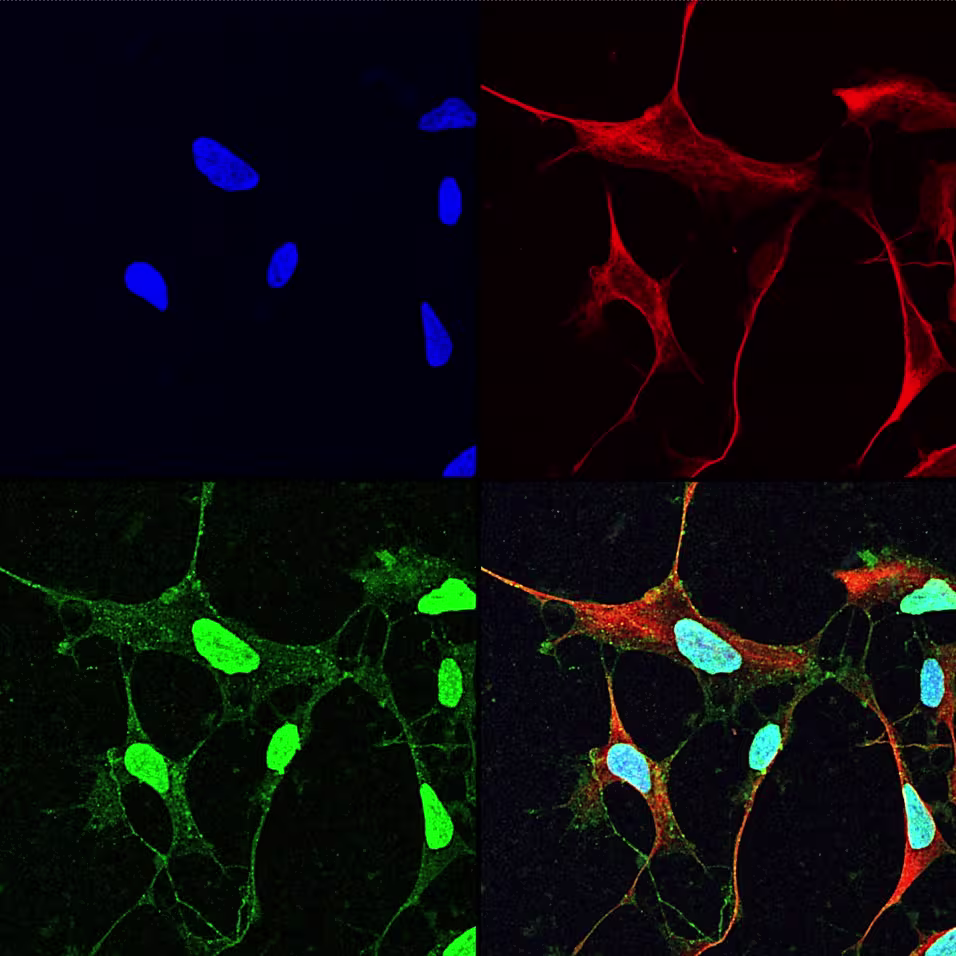 Cancer neuroscience