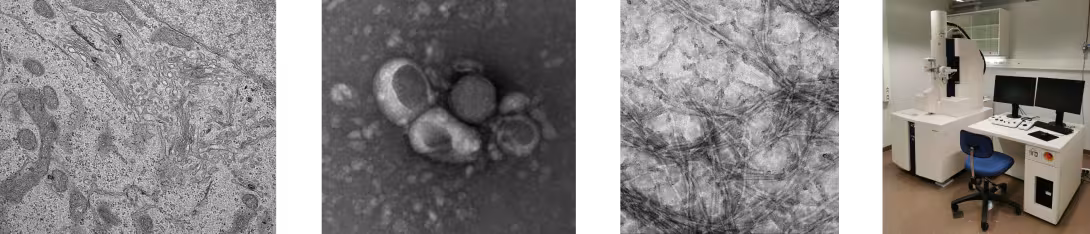 Transmission electron microscopy examples 